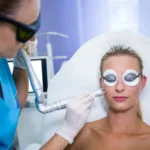 female-patient-getting-rf-lifting-procedure