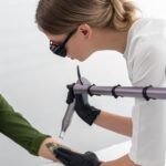tatoo removal