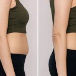woman-with-belly-with-excess-fat-toned-slim-stomach-with-abs-before-after-losing-weight