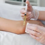 high-angle-patient-getting-elbow-prp-treatment